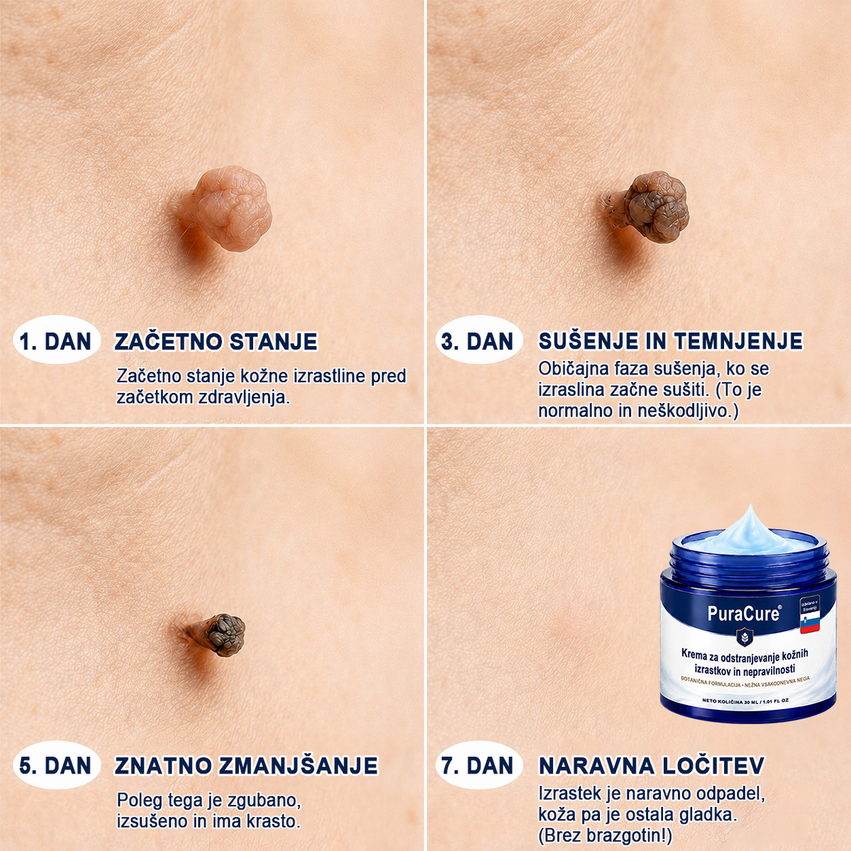 PuraCure® 𝟕 𝐃𝐢𝐞𝐧ų 𝐊𝐫ė𝐦𝐚𝐬 𝐧𝐮𝐨 𝐎𝐝𝐨𝐬 𝐈š𝐨𝐤𝐢ų 𝐢𝐫 𝐏𝐢𝐠𝐦𝐞𝐧𝐭𝐢𝐧𝐢ų 𝐃ė𝐦𝐢ų (𝐍𝐞𝐬𝐤𝐚𝐮𝐬𝐦𝐢𝐧𝐠𝐚 𝐅𝐨𝐫𝐦𝐮𝐥ė – 𝐁𝐞 𝐑𝐚𝐧𝐝ų)🍁