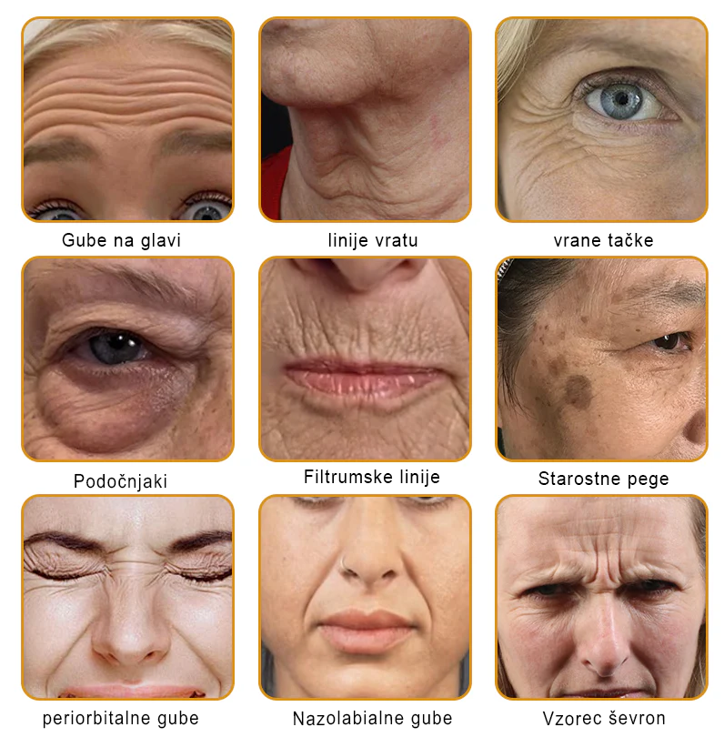 👨‍⚕Sinvie® Krema za obnovo kože z čebeljim strupom | 50 ml | Priporočeno dermatologov