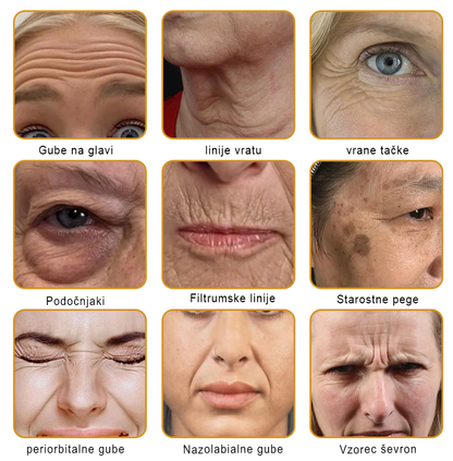 👨‍⚕Sinvie® Krema za obnovo kože z čebeljim strupom | 50 ml | Priporočeno dermatologov