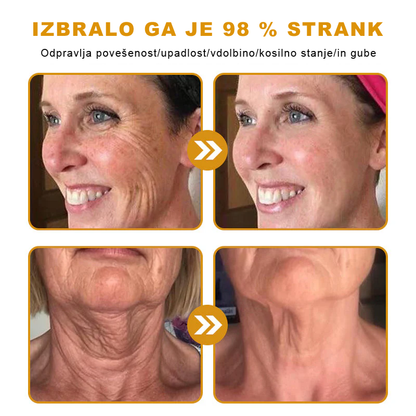 👨‍⚕Sinvie® Krema za obnovo kože z čebeljim strupom | 50 ml | Priporočeno dermatologov