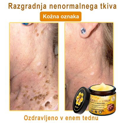 👨‍⚕Sinvie® Krema za obnovo kože z čebeljim strupom | 50 ml | Priporočeno dermatologov