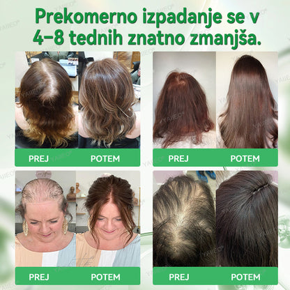 𝒀𝑨𝑰𝑰𝑬𝑶® 𝑺𝒆𝒓𝒖𝒎 𝒛𝒂 𝒔𝒑𝒐𝒅𝒃𝒖𝒋𝒂𝒏𝒋𝒆 𝒓𝒂𝒔𝒕𝒊 𝒍𝒂𝒔 – 𝑵𝒆𝒃𝒐𝒍𝒆č𝒂 𝒏𝒆𝒈𝒂 𝒍𝒂𝒔