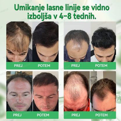 𝒀𝑨𝑰𝑰𝑬𝑶® 𝑺𝒆𝒓𝒖𝒎 𝒛𝒂 𝒔𝒑𝒐𝒅𝒃𝒖𝒋𝒂𝒏𝒋𝒆 𝒓𝒂𝒔𝒕𝒊 𝒍𝒂𝒔 – 𝑵𝒆𝒃𝒐𝒍𝒆č𝒂 𝒏𝒆𝒈𝒂 𝒍𝒂𝒔