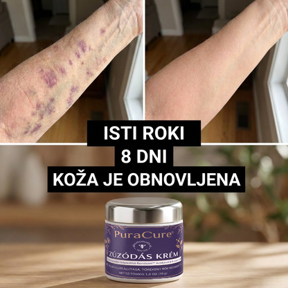 🪻 100K+ PRODAJ 💁‍♀️ – PuraCure® Krema za obnovo modric in krepitev kože