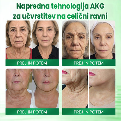 🌿🌿Medistart® AKG – Učvrstitvena nega kože proti znakom staranja
