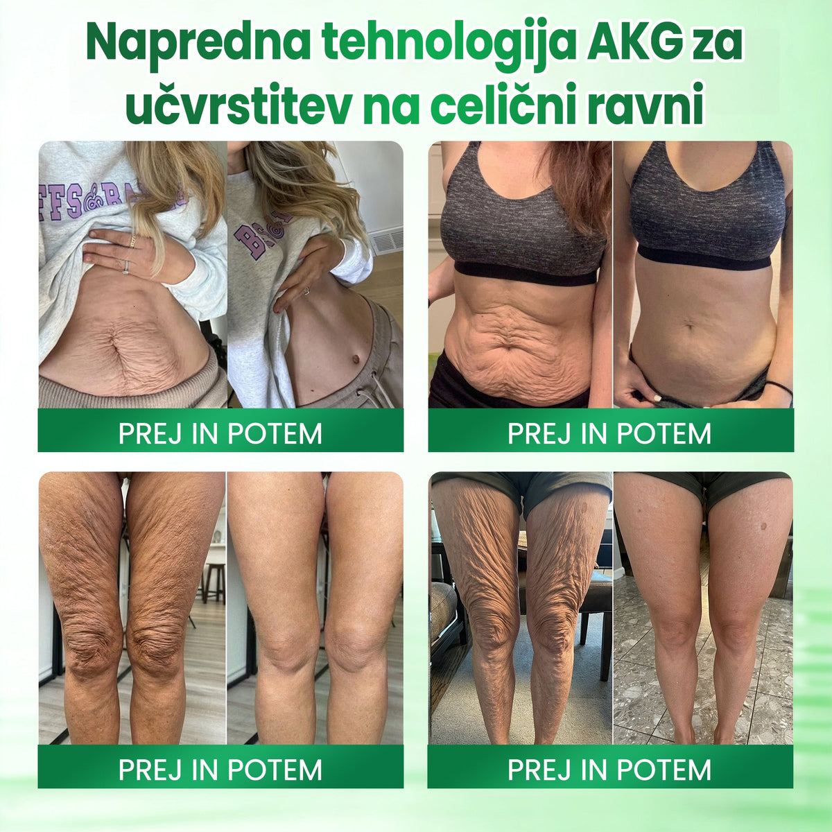 🌿🌿Medistart® AKG – Učvrstitvena nega kože proti znakom staranja