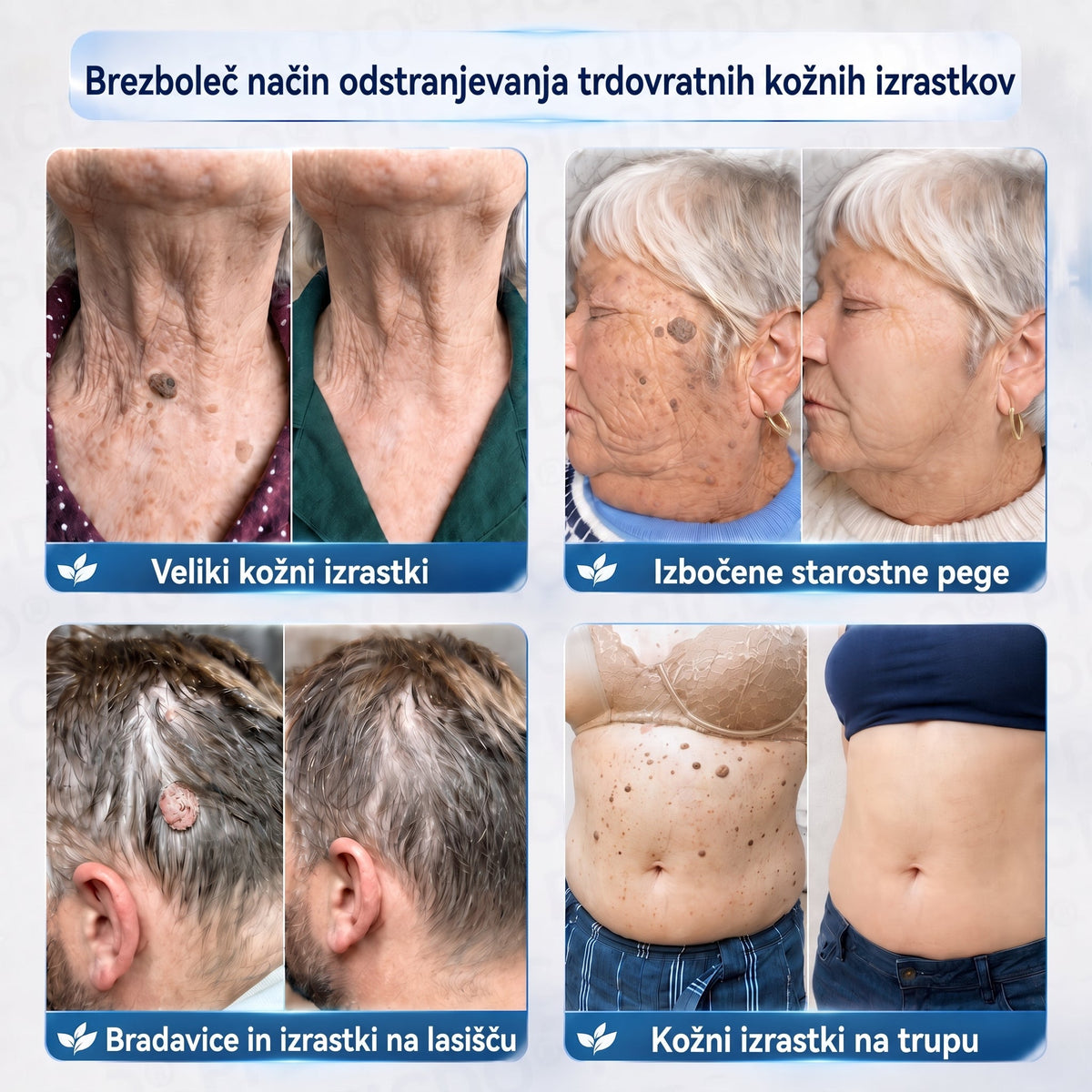 PuraCure® 𝟕 𝐃𝐢𝐞𝐧ų 𝐊𝐫ė𝐦𝐚𝐬 𝐧𝐮𝐨 𝐎𝐝𝐨𝐬 𝐈š𝐨𝐤𝐢ų 𝐢𝐫 𝐏𝐢𝐠𝐦𝐞𝐧𝐭𝐢𝐧𝐢ų 𝐃ė𝐦𝐢ų (𝐍𝐞𝐬𝐤𝐚𝐮𝐬𝐦𝐢𝐧𝐠𝐚 𝐅𝐨𝐫𝐦𝐮𝐥ė – 𝐁𝐞 𝐑𝐚𝐧𝐝ų)🍁