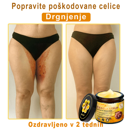 👨‍⚕Sinvie® Krema za obnovo kože z čebeljim strupom | 50 ml | Priporočeno dermatologov