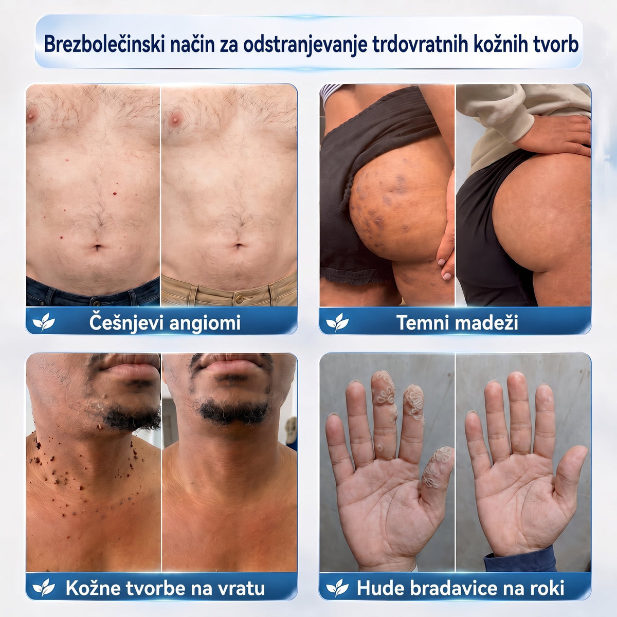 PuraCure® 𝟕 𝐃𝐢𝐞𝐧ų 𝐊𝐫ė𝐦𝐚𝐬 𝐧𝐮𝐨 𝐎𝐝𝐨𝐬 𝐈š𝐨𝐤𝐢ų 𝐢𝐫 𝐏𝐢𝐠𝐦𝐞𝐧𝐭𝐢𝐧𝐢ų 𝐃ė𝐦𝐢ų (𝐍𝐞𝐬𝐤𝐚𝐮𝐬𝐦𝐢𝐧𝐠𝐚 𝐅𝐨𝐫𝐦𝐮𝐥ė – 𝐁𝐞 𝐑𝐚𝐧𝐝ų)🍁