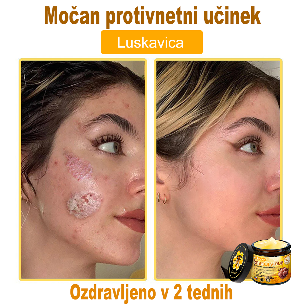 👨‍⚕Sinvie® Krema za obnovo kože z čebeljim strupom | 50 ml | Priporočeno dermatologov