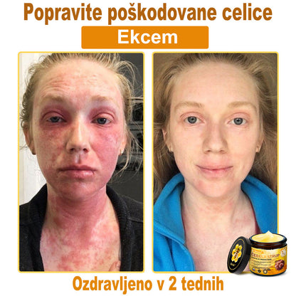 👨‍⚕Sinvie® Krema za obnovo kože z čebeljim strupom | 50 ml | Priporočeno dermatologov