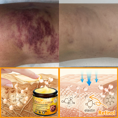 👨‍⚕Sinvie® Krema za obnovo kože z čebeljim strupom | 50 ml | Priporočeno dermatologov