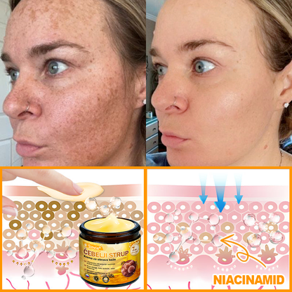 👨‍⚕Sinvie® Krema za obnovo kože z čebeljim strupom | 50 ml | Priporočeno dermatologov