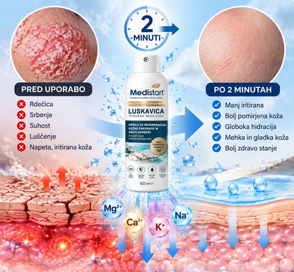 🌿Medistart® POSEBNA NEGA KOŽE PRI LUSKAVICI