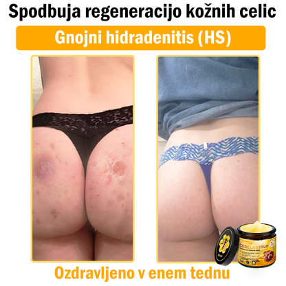 👨‍⚕Sinvie® Krema za obnovo kože z čebeljim strupom | 50 ml | Priporočeno dermatologov